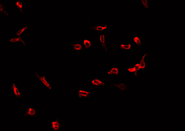 RACGAP1 / MGCRACGAP Antibody - Staining COS7 cells by IF/ICC. The samples were fixed with PFA and permeabilized in 0.1% Triton X-100, then blocked in 10% serum for 45 min at 25°C. The primary antibody was diluted at 1:200 and incubated with the sample for 1 hour at 37°C. An Alexa Fluor 594 conjugated goat anti-rabbit IgG (H+L) Ab, diluted at 1/600, was used as the secondary antibody.