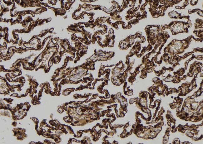 RACGAP1 / MGCRACGAP Antibody - 1:100 staining human lung tissue by IHC-P. The sample was formaldehyde fixed and a heat mediated antigen retrieval step in citrate buffer was performed. The sample was then blocked and incubated with the antibody for 1.5 hours at 22°C. An HRP conjugated goat anti-rabbit antibody was used as the secondary.