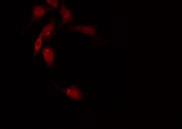 RACGAP1 / MGCRACGAP Antibody - Staining HeLa cells by IF/ICC. The samples were fixed with PFA and permeabilized in 0.1% Triton X-100, then blocked in 10% serum for 45 min at 25°C. The primary antibody was diluted at 1:200 and incubated with the sample for 1 hour at 37°C. An Alexa Fluor 594 conjugated goat anti-rabbit IgG (H+L) antibody, diluted at 1/600, was used as secondary antibody.