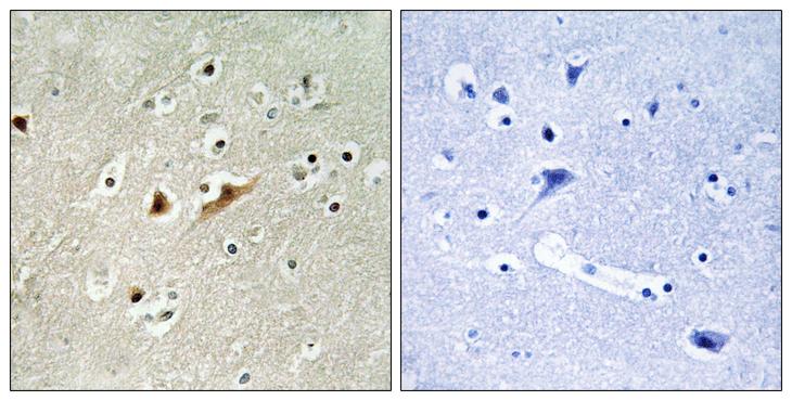 RACGAP1 / MGCRACGAP Antibody - Peptide - + Immunohistochemistry analysis of paraffin-embedded human brain tissue, using RGAP1 antibody.