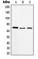 RACGAP1 / MGCRACGAP Antibody - Western blot analysis of MGCRACGAP expression in Raji (A); K562 (B); A431 (C) whole cell lysates.