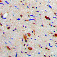RACGAP1 / MGCRACGAP Antibody - Immunohistochemical analysis of MGCRACGAP staining in human brain formalin fixed paraffin embedded tissue section. The section was pre-treated using heat mediated antigen retrieval with sodium citrate buffer (pH 6.0). The section was then incubated with the antibody at room temperature and detected using an HRP conjugated compact polymer system. DAB was used as the chromogen. The section was then counterstained with hematoxylin and mounted with DPX.