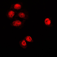 RACGAP1 / MGCRACGAP Antibody - Immunofluorescent analysis of MGCRACGAP staining in K562 cells. Formalin-fixed cells were permeabilized with 0.1% Triton X-100 in TBS for 5-10 minutes and blocked with 3% BSA-PBS for 30 minutes at room temperature. Cells were probed with the primary antibody in 3% BSA-PBS and incubated overnight at 4 C in a humidified chamber. Cells were washed with PBST and incubated with a DyLight 594-conjugated secondary antibody (red) in PBS at room temperature in the dark. DAPI was used to stain the cell nuclei (blue).