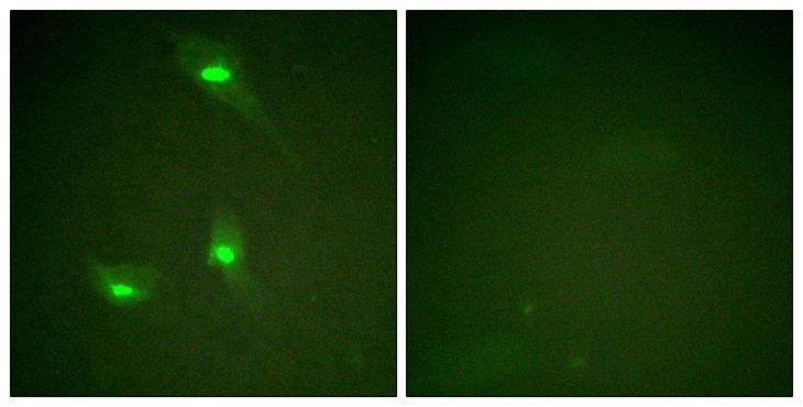 RACGAP1 / MGCRACGAP Antibody - Immunofluorescence analysis of HeLa cells, using GTPase Activating Protein (Phospho-Ser387) Antibody. The picture on the right is blocked with the phospho peptide.