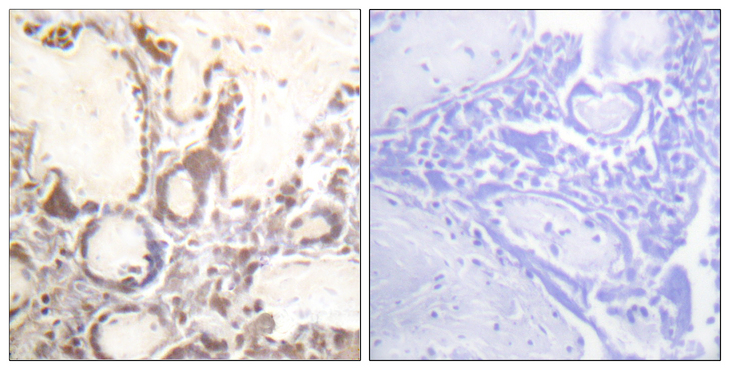 RACGAP1 / MGCRACGAP Antibody - Immunohistochemistry analysis of paraffin-embedded human placenta, using GTPase Activating Protein (Phospho-Ser387) Antibody. The picture on the right is blocked with the phospho peptide.