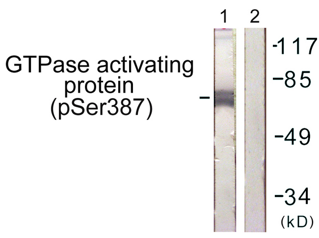RACGAP1 / MGCRACGAP Antibody - Western blot analysis of lysates from COS7 cells, using GTPase Activating Protein (Phospho-Ser387) Antibody. The lane on the right is blocked with the phospho peptide.