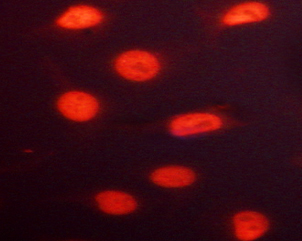 RACGAP1 / MGCRACGAP Antibody - Staining HeLa cells by IF/ICC. The samples were fixed with PFA and permeabilized in 0.1% saponin prior to blocking in 10% serum for 45 min at 37°C. The primary antibody was diluted 1/400 and incubated with the sample for 1 hour at 37°C. A Alexa Fluor 594 conjugated goat polyclonal to rabbit IgG (H+L), diluted 1/600 was used as secondary antibody.