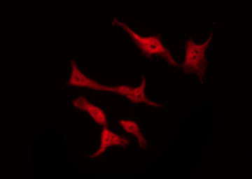 RACGAP1 / MGCRACGAP Antibody - Staining COS7 cells by IF/ICC. The samples were fixed with PFA and permeabilized in 0.1% Triton X-100, then blocked in 10% serum for 45 min at 25°C. The primary antibody was diluted at 1:200 and incubated with the sample for 1 hour at 37°C. An Alexa Fluor 594 conjugated goat anti-rabbit IgG (H+L) Ab, diluted at 1/600, was used as the secondary antibody.