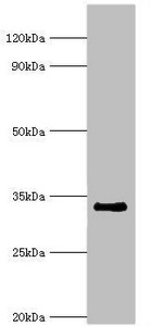 RAD1 Antibody - Western blot All lanes: Cell cycle checkpoint protein RAD1 antibody at 6µg/ml + NIH/3T3 whole cell lysate Secondary Goat polyclonal to rabbit IgG at 1/10000 dilution Predicted band size: 32, 28, 8 kDa Observed band size: 32 kDa