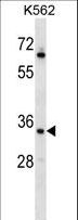 RAD1 Antibody - RAD1 Antibody western blot of K562 cell line lysates (35 ug/lane). The RAD1 antibody detected the RAD1 protein (arrow).