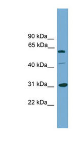 RAD1 Antibody - RAD1 antibody Western blot of COLO205 cell lysate. This image was taken for the unconjugated form of this product. Other forms have not been tested.
