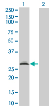 RAD1 Antibody - Western blot of RAD1 expression in transfected 293T cell line by RAD1 monoclonal antibody (M01), clone 1G2.