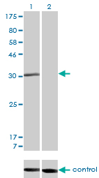 RAD1 Antibody - Western blot of RAD1 over-expressed 293 cell line, cotransfected with RAD1 Validated Chimera RNAi (Lane 2) or non-transfected control (Lane 1). Blot probed with RAD1 monoclonal antibody, clone 1G2. GAPDH ( 36.1 kD ) used as specificity an.