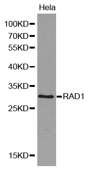 RAD1 Antibody - Western blot analysis of Hela cell lysate.