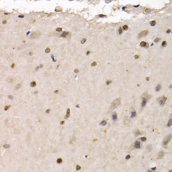 RAD1 Antibody - Immunohistochemistry of paraffin-embedded rat brain tissue.