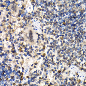 RAD1 Antibody - Immunohistochemistry of paraffin-embedded mouse spleen tissue.