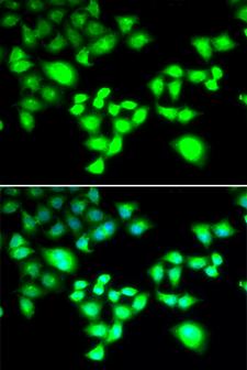 RAD1 Antibody - Immunofluorescence analysis of MCF7 cells.