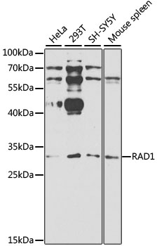 RAD1 Antibody - Western blot analysis of extracts of various cell lines, using RAD1 antibody at 1:1000 dilution. The secondary antibody used was an HRP Goat Anti-Rabbit IgG (H+L) at 1:10000 dilution. Lysates were loaded 25ug per lane and 3% nonfat dry milk in TBST was used for blocking. An ECL Kit was used for detection and the exposure time was 90s.