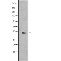 RAD1 Antibody - Western blot analysis of RAD1 expression in HeLa cells lysate. The lane on the left is treated with the antigen-specific peptide.