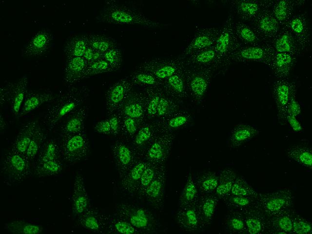 RAD1 Antibody - Immunofluorescence staining of RAD1 in U2OS cells. Cells were fixed with 4% PFA, permeabilzed with 0.1% Triton X-100 in PBS, blocked with 10% serum, and incubated with rabbit anti-Human RAD1 polyclonal antibody (dilution ratio 1:200) at 4°C overnight. Then cells were stained with the Alexa Fluor 488-conjugated Goat Anti-rabbit IgG secondary antibody (green). Positive staining was localized to Nucleus.
