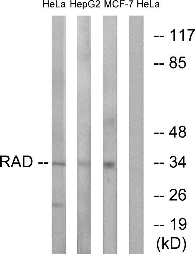 RAD1 Antibody - Western blot analysis of extracts from HeLa cells, HepG2 cells and MCF-7 cells, using RAD antibody.