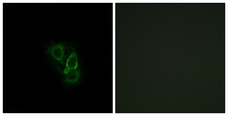RAD1 Antibody - Peptide - + Immunofluorescence analysis of A549 cells, using RAD antibody.