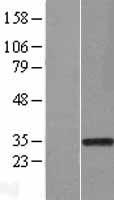 RAD1 Protein - Western validation with an anti-DDK antibody * L: Control HEK293 lysate R: Over-expression lysate