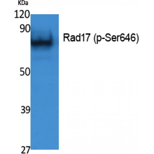 RAD17 Antibody - Western blot of Phospho-Rad17 (S646) antibody