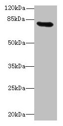 RAD17 Antibody - Western blot All lanes: RAD17 antibody at 12µg/ml + Mouse thymus tissue Secondary Secondary Goat polyclonal to rabbit IgG at 1/10000 dilution Predicted band size: 78, 76, 58, 67 kDa Observed band size: 78 kDa