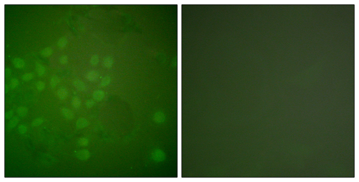 RAD17 Antibody - Immunofluorescence analysis of A549 cells, using RAD17 Antibody. The picture on the right is blocked with the synthesized peptide.