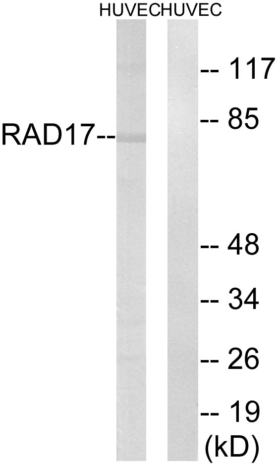 RAD17 Antibody - Western blot analysis of lysates from HUVEC cells, using RAD17 Antibody. The lane on the right is blocked with the synthesized peptide.