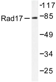 RAD17 Antibody - Western blot of Rad17 (A639) pAb in extracts from A549 HUVEC cells.