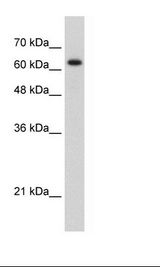 RAD17 Antibody - Jurkat Cell Lysate.  This image was taken for the unconjugated form of this product. Other forms have not been tested.