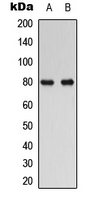 RAD17 Antibody - Western blot analysis of RAD17 expression in human Oral cancer (A); HUVEC (B) whole cell lysates.
