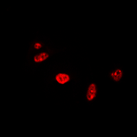 RAD17 Antibody - Immunofluorescent analysis of RAD17 staining in A549 cells. Formalin-fixed cells were permeabilized with 0.1% Triton X-100 in TBS for 5-10 minutes and blocked with 3% BSA-PBS for 30 minutes at room temperature. Cells were probed with the primary antibody in 3% BSA-PBS and incubated overnight at 4 deg C in a humidified chamber. Cells were washed with PBST and incubated with a DyLight 594-conjugated secondary antibody (red) in PBS at room temperature in the dark. DAPI was used to stain the cell nuclei (blue).