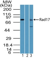 RAD17 Antibody - Western blot of Rad17 in HeLa cell lysate in the 1) absence and 2) presence of immunizing peptide, and 3) NIH 3T3 cell lysate using Peptide-affinity Purified Polyclonal Antibody to RAD17 at3 ug/ml.