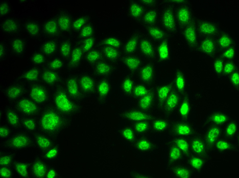 RAD17 Antibody - Immunofluorescence analysis of MCF-7 cells.