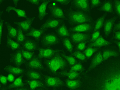 RAD17 Antibody - Immunofluorescence analysis of A549 cells.
