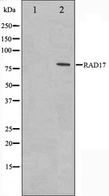 RAD17 Antibody - Western blot analysis on HeLa cell lysates using RAD17 antibody. The lane on the left is treated with the antigen-specific peptide.