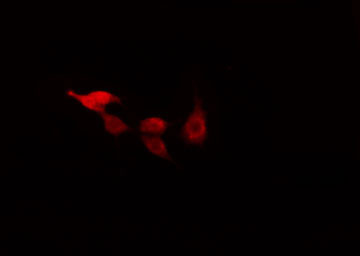 RAD17 Antibody - Staining HeLa cells by IF/ICC. The samples were fixed with PFA and permeabilized in 0.1% Triton X-100, then blocked in 10% serum for 45 min at 25°C. The primary antibody was diluted at 1:200 and incubated with the sample for 1 hour at 37°C. An Alexa Fluor 594 conjugated goat anti-rabbit IgG (H+L) antibody, diluted at 1/600, was used as secondary antibody.