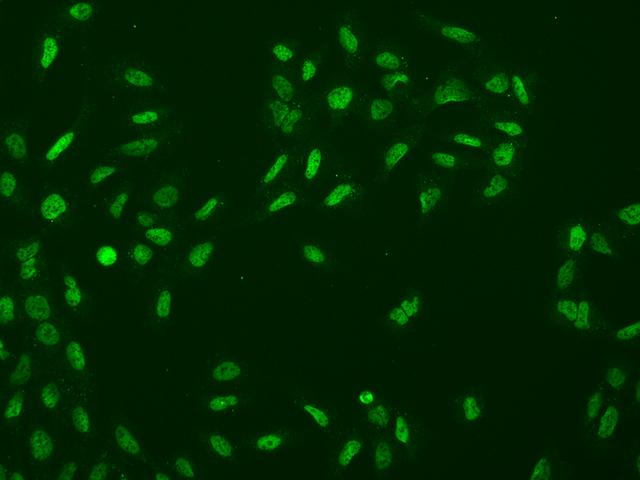 RAD17 Antibody - Immunofluorescence staining of RAD17 in U2OS cells. Cells were fixed with 4% PFA, permeabilzed with 0.1% Triton X-100 in PBS, blocked with 10% serum, and incubated with rabbit anti-Human RAD17 polyclonal antibody (dilution ratio 1:200) at 4°C overnight. Then cells were stained with the Alexa Fluor 488-conjugated Goat Anti-rabbit IgG secondary antibody (green). Positive staining was localized to Nucleus.