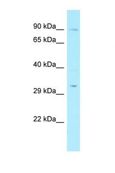 RAD17 Antibody - RAD17 antibody Western blot of Fetal Liver lysate. Antibody concentration 1 ug/ml. This image was taken for the unconjugated form of this product. Other forms have not been tested.
