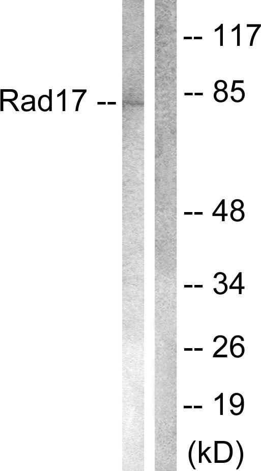 RAD17 Antibody - Western blot analysis of extracts from A549 cells, using Rad17 (Ab-645) antibody.