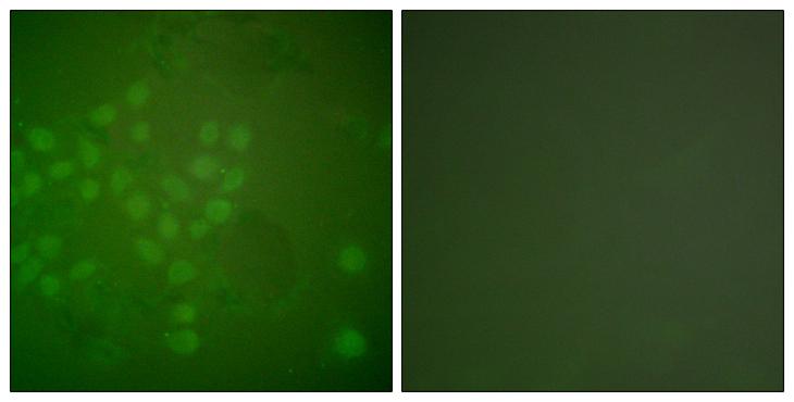 RAD17 Antibody - Peptide - + Immunofluorescence analysis of A549 cells, using Rad17 (Ab-645) antibody.