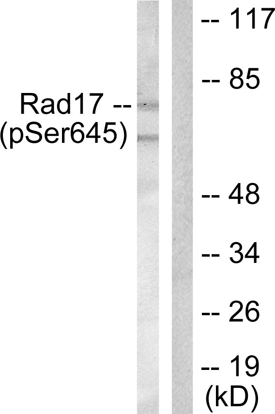RAD17 Antibody - Western blot analysis of lysates from HeLa cells treated with UV 15', using RAD17 (Phospho-Ser645) Antibody. The lane on the right is blocked with the phospho peptide.
