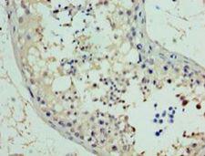 RAD18 Antibody - Immunohistochemistry of paraffin-embedded human testis using PA889102LA01HU at 1:100 dilution.  This image was taken for the unconjugated form of this product. Other forms have not been tested.