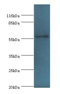 RAD18 Antibody - Western blot. All lanes: E3 ubiquitin-protein ligase RAD18 antibody at 2 ug/ml+COLO205 whole cell lysate. Secondary antibody: Goat polyclonal to rabbit at 1:10000 dilution. Predicted band size: 56 kDa. Observed band size: 56 kDa.  This image was taken for the unconjugated form of this product. Other forms have not been tested.