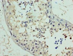 RAD18 Antibody - Immunohistochemistry of paraffin-embedded human testis using PA889102LA01HU at 1:100 dilution.  This image was taken for the unconjugated form of this product. Other forms have not been tested.