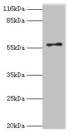 RAD18 Antibody - Western blot All lanes: E3 ubiquitin-protein ligase RAD18 antibody at 2µg/ml + COLO205 whole cell lysate Secondary Goat polyclonal to rabbit IgG at 1/10000 dilution Predicted band size: 56 kDa Observed band size: 56 kDa