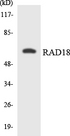 RAD18 Antibody - Western blot analysis of the lysates from COLO205 cells using RAD18 antibody.